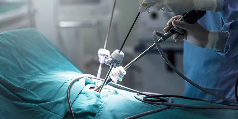 Benefits of Laparoscopic Surgeries: