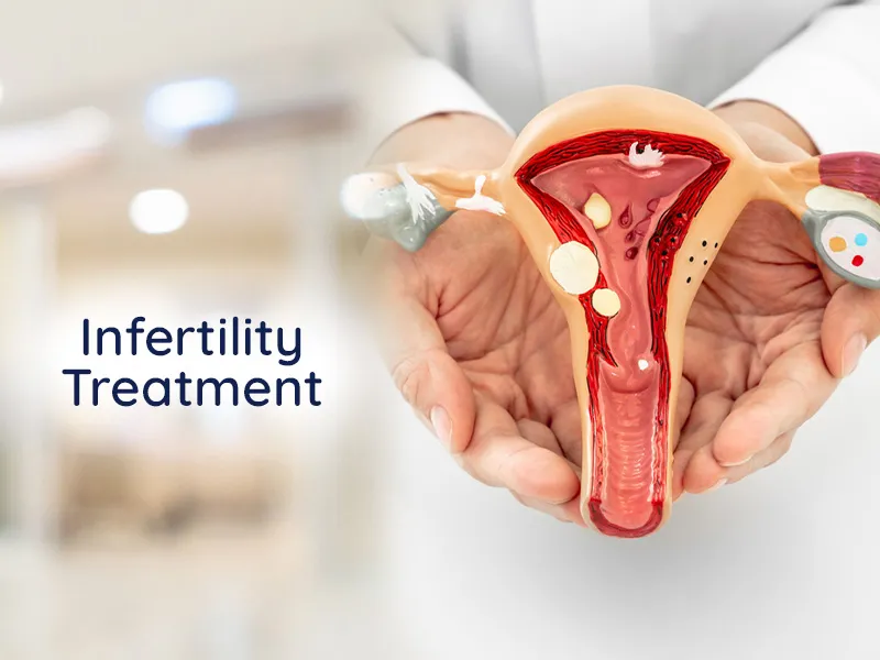 Key Features of Infertility Management: