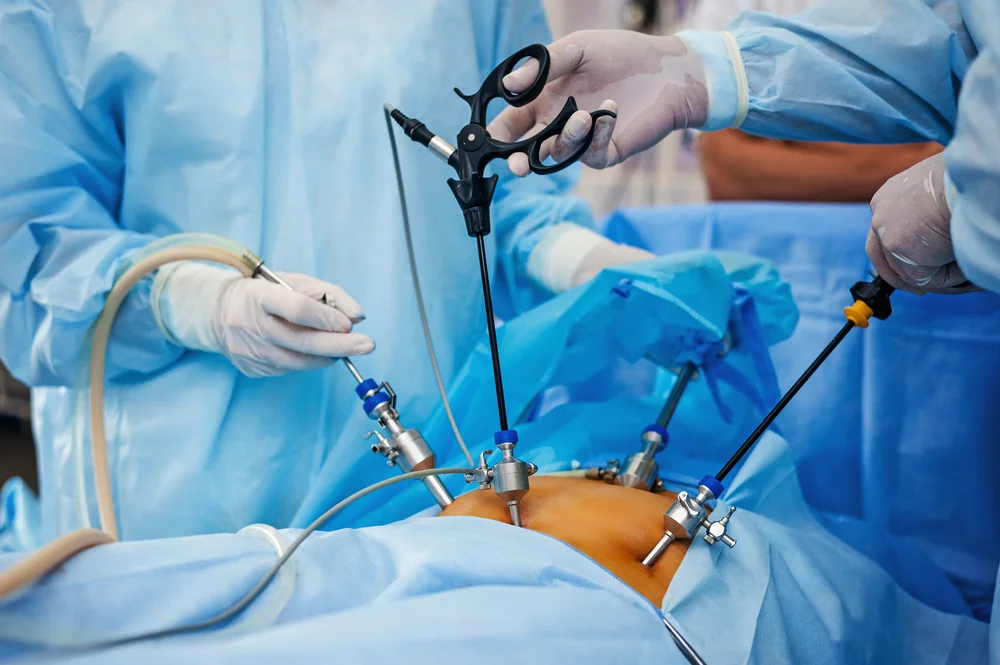 Open and Laparoscopic Gynecological Surgeries